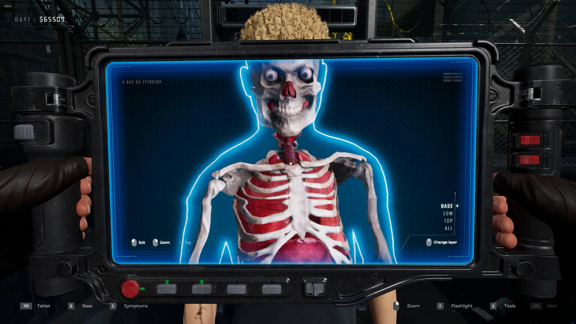 检疫区：最后一站截图